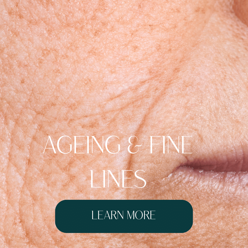 Skin clinic, skin clinic near me, skin clinic manchester, cosmetic skin clinic, laser and skin clinic, laser skin clinic, manchester skin clinic, private skin clinic, laser light skin clinic, skin tag removal, skin tags, skin care routine, skin conditions, skin care products, how to remove skin tags, best skin care products, skincare, skin care, skin care sets, how to get clear skin, skin pigmentation, skin care routine, best skin care products, skin care routine steps, alumiermd, alumiermd chemical peel, alumiermd uk, alumiermd peel, alumiermd chemical peel, alumiermd peel before and after, alumiermd glow peel, alumiermd chemical peels, manchester clinic, manchester clinics, manchester salon, manchester salons, salford, salford clinic, salford clinics, mediacity, mediacityuk, manchester spa, manchester skin clinic, manchester beauty salon, manchester, medical grade skin care, skin care routine for men, Chemical peel, chemical peel before and after, chemical peel near me, chemical peel facial, tca chemical peel, what is a chemical peel, chemical peel for hyperpigmentation, chemical peel benefits, what is chemical peel, benefits of a chemical peel, benefits of chemical peel, chemical peel for pigmentation, phenol chemical peel, chemical peel price, deep chemical peel, chemical peel cost, how much is a chemical peel uk, what does a chemical peel do, chemical peel treatment, chemical peel aftercare, best chemical peel, chemical peel for acne scars, how much is a chemical peel, chemical peel for acne, deep chemical peel before and after, chemical peel for wrinkles, chemical peel manchester, chemical peel course, chemical peel results, chemical peel cost uk, best chemical peel for hyperpigmentation, chemical peel vs microneedling, under eye chemical peel, skin chemical peel, chemical peel courses, cost of chemical peel uk, chemical peel and microneedling, medium chemical peel, chemical peel under eyes, chemical peel for melasma, facial chemical peel, chemical peel uk, chemical peel side effects, microneedling vs chemical peel, chemical peel for scars, microneedling and chemical peel, face chemical peel near me, face chemical peel, what’s a chemical peel, light chemical peel, does a chemical peel hurt, chemical peel for under eyes, types of chemical peel, chemical peel for pores, melasma chemical peel, chemical peel for blackheads, alumier chemical peel, after a chemical peel, chemical peel after, chemical peel for dark circles, chemical peel for dar skin, chemical peel for black skin, professional chemical peel, how long does a chemical peel take, what is a chemical peel facial, chemical peel products, alumiermd, alumiermd chemical peel, alumiermd uk, alumiermd peel, alumiermd chemical peel, alumiermd peel before and after, alumiermd glow peel, alumiermd chemical peels, manchester clinic, manchester clinics, manchester salon, manchester salons, salford, salford clinic, salford clinics, mediacity, mediacityuk, manchester spa, manchester skin clinic, manchester beauty salon, manchester