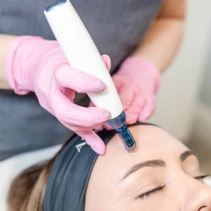 microneedling, microneedling before and after, microneedling near me, manchester, mediacity, mediacityuk, salford quays, salford, microneedling facial, what is microneedling, microneedling benefits, microneedling manchester, manchester skin, manchester salon, manchester skin clinic, manchester beauty, manchester beauty clinic, microneedling pen, is microneedling worth it, microneedling acne scars, acne scars, acne scarring, derma pen microneedling, microneedling for pigmentation, skin pen microneedling, microneedling cost uk, microneedling aftercare, benefits of microneedling, microneedling and rosacea, microneedling prices, how long after microneedling can i wear makeup, how long does microneedling last, how often microneedling, microneedling vs microdermabrasion, microneedling reviews, microneedling rosacea, microneedling for wrinkles, microneedling uk, is microneedling painful, microneedling hyperpigmentation, cost of microneedling, what is microneedling good for, skin microneedling, microneedling downtime, microneedling stretch marks before and after, microneedling side effects, microneedling courses, microneedling serums