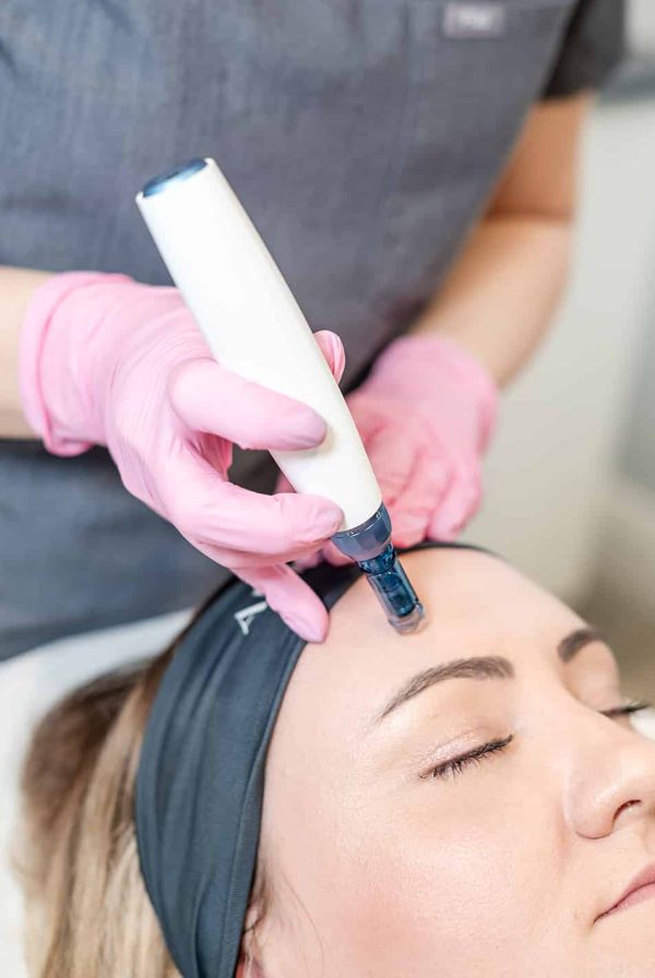 microneedling, microneedling before and after, microneedling near me, manchester, mediacity, mediacityuk, salford quays, salford, microneedling facial, what is microneedling, microneedling benefits, microneedling manchester, manchester skin, manchester salon, manchester skin clinic, manchester beauty, manchester beauty clinic, microneedling pen, is microneedling worth it, microneedling acne scars, acne scars, acne scarring, derma pen microneedling, microneedling for pigmentation, skin pen microneedling, microneedling cost uk, microneedling aftercare, benefits of microneedling, microneedling and rosacea, microneedling prices, how long after microneedling can i wear makeup, how long does microneedling last, how often microneedling, microneedling vs microdermabrasion, microneedling reviews, microneedling rosacea, microneedling for wrinkles, microneedling uk, is microneedling painful, microneedling hyperpigmentation, cost of microneedling, what is microneedling good for, skin microneedling, microneedling downtime, microneedling stretch marks before and after, microneedling side effects, microneedling courses, microneedling serums