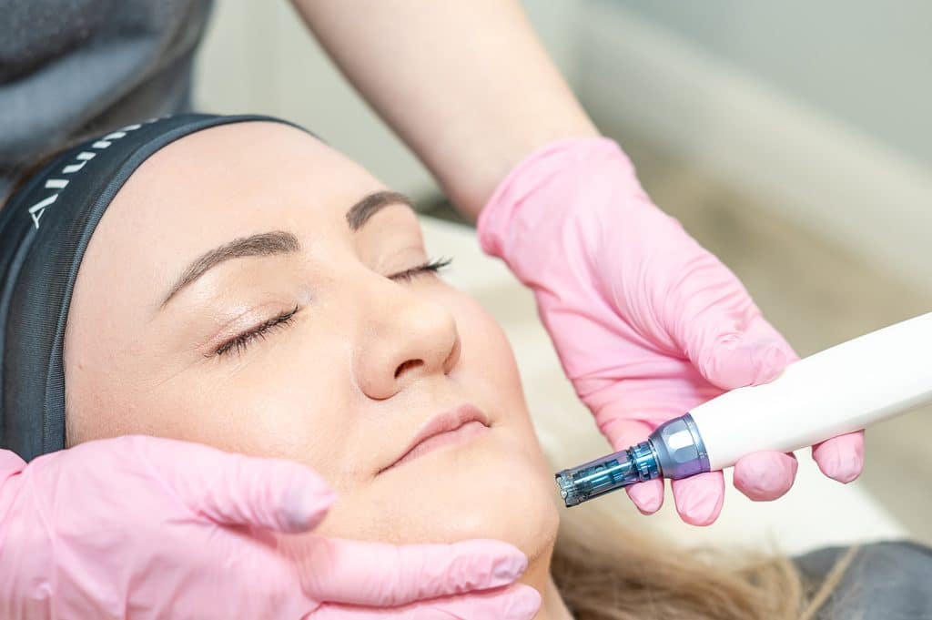 is micro needling worth the money, microneedling, microneedling before and after, microneedling near me, manchester, mediacity, mediacityuk, salford quays, salford, microneedling facial, what is microneedling, microneedling benefits, microneedling manchester, manchester skin, manchester salon, manchester skin clinic, manchester beauty, manchester beauty clinic, microneedling pen, is microneedling worth it, microneedling acne scars, acne scars, acne scarring, derma pen microneedling, microneedling for pigmentation, skin pen microneedling, microneedling cost uk, microneedling aftercare, benefits of microneedling, microneedling and rosacea, microneedling prices, how long after microneedling can i wear makeup, how long does microneedling last, how often microneedling, microneedling vs microdermabrasion, microneedling reviews, microneedling rosacea, microneedling for wrinkles, microneedling uk, is microneedling painful, microneedling hyperpigmentation, cost of microneedling, what is microneedling good for, skin microneedling, microneedling downtime, microneedling stretch marks before and after, microneedling side effects, microneedling courses, microneedling serums, manchester clinic, manchester clinics, manchester salon, manchester salons, salford, salford clinic, salford clinics, mediacity, mediacityuk, manchester spa, manchester skin clinic, manchester beauty salon, manchester