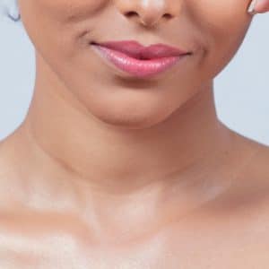 Alkaline Wash - Upper Lip and Chin