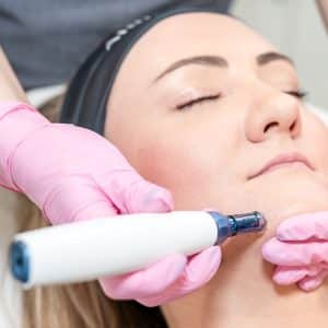 microneedling, microneedling face and neck, microneedling face, microneedling neck, microneedling before and after, microneedling near me, manchester, mediacity, mediacityuk, salford quays, salford, microneedling facial, what is microneedling, microneedling benefits, microneedling manchester, manchester skin, manchester salon, manchester skin clinic, manchester beauty, manchester beauty clinic, microneedling pen, is microneedling worth it, microneedling acne scars, acne scars, acne scarring, derma pen microneedling, microneedling for pigmentation, skin pen microneedling, microneedling cost uk, microneedling aftercare, benefits of microneedling, microneedling and rosacea, microneedling prices, how long after microneedling can i wear makeup, how long does microneedling last, how often microneedling, microneedling vs microdermabrasion, microneedling reviews, microneedling rosacea, microneedling for wrinkles, microneedling uk, is microneedling painful, microneedling hyperpigmentation, cost of microneedling, what is microneedling good for, skin microneedling, microneedling downtime, microneedling stretch marks before and after, microneedling side effects, microneedling courses, microneedling serums