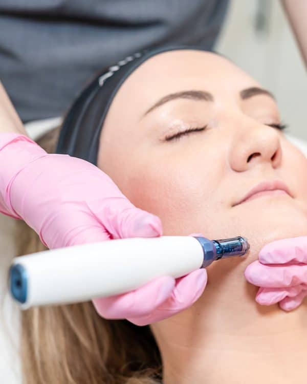 microneedling, microneedling face and neck, microneedling face, microneedling neck, microneedling before and after, microneedling near me, manchester, mediacity, mediacityuk, salford quays, salford, microneedling facial, what is microneedling, microneedling benefits, microneedling manchester, manchester skin, manchester salon, manchester skin clinic, manchester beauty, manchester beauty clinic, microneedling pen, is microneedling worth it, microneedling acne scars, acne scars, acne scarring, derma pen microneedling, microneedling for pigmentation, skin pen microneedling, microneedling cost uk, microneedling aftercare, benefits of microneedling, microneedling and rosacea, microneedling prices, how long after microneedling can i wear makeup, how long does microneedling last, how often microneedling, microneedling vs microdermabrasion, microneedling reviews, microneedling rosacea, microneedling for wrinkles, microneedling uk, is microneedling painful, microneedling hyperpigmentation, cost of microneedling, what is microneedling good for, skin microneedling, microneedling downtime, microneedling stretch marks before and after, microneedling side effects, microneedling courses, microneedling serums